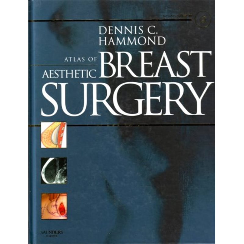 Atlas of Aesthetic Breast Surgery - Include DVD